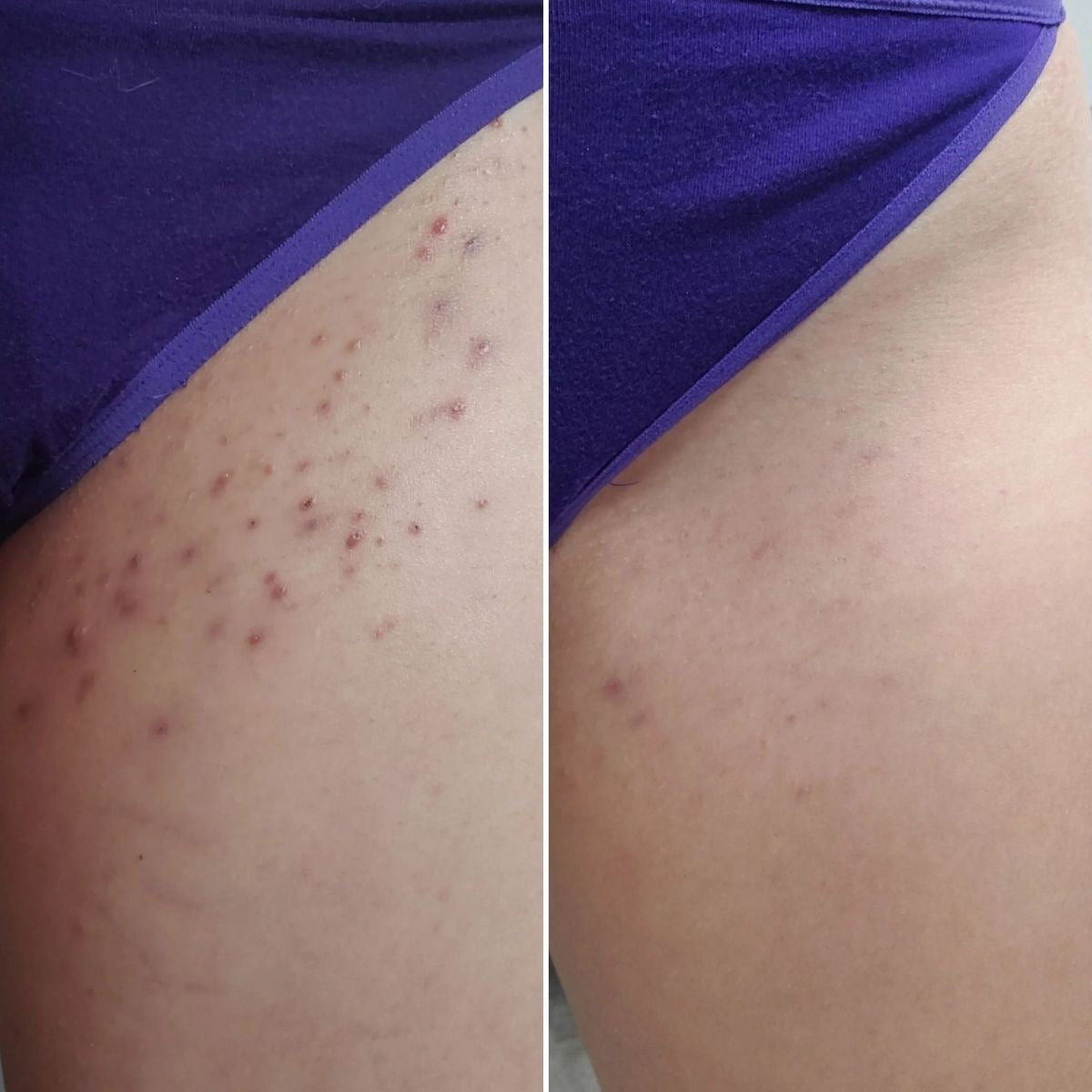 Taches & éclat de ton intimité